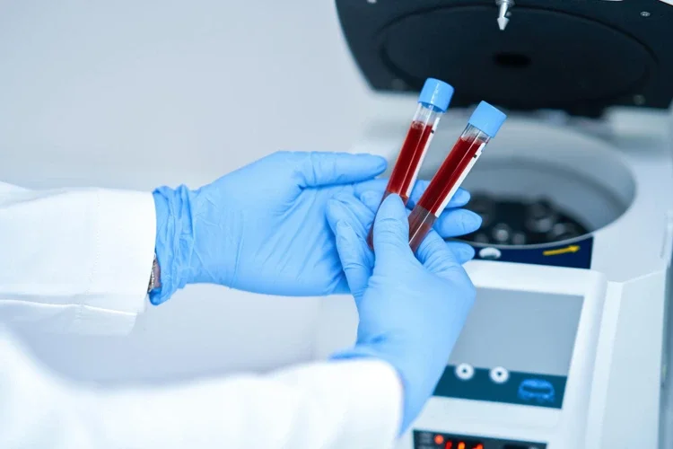 Blood samples in test tubes to be tested and analysed in a laboratory.
