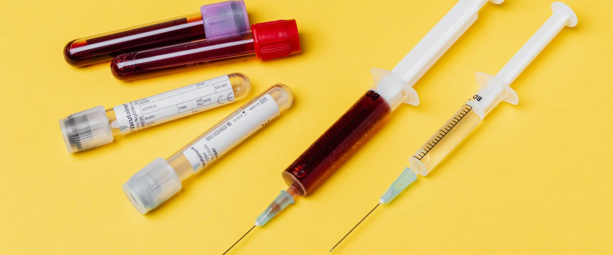 Vials of patients' blood and syringes to draw their blood for blood testing.