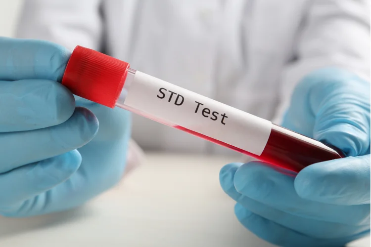 Regular STI screening helps maintain sexual health and prevent infections.