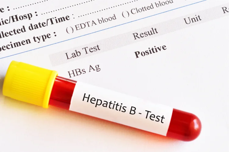STD blood test showing a positive result for Hepatitis B, which may be a true or false positive.