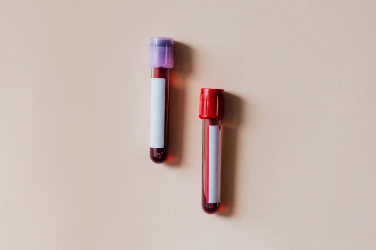 Test tubes containing blood samples for STD testing.